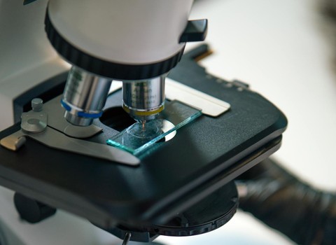 Bild von Studie: Neuer Ansatz zur Verstärkung von CFTR-Therapien