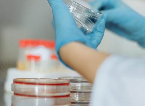 Bild von mRNA-Therapie bei CF: Aktuelle Studie untersucht neuen Ansatz